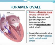 Bahasa Indonesia Oval